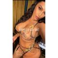  is Female Escorts. | San Francisco | California | United States | EscortsLiaison