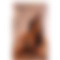  is Female Escorts. | Edinburgh | United Kingdom | United Kingdom | EscortsLiaison