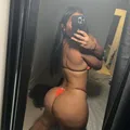  is Female Escorts. | Albany | New York | United States | EscortsLiaison